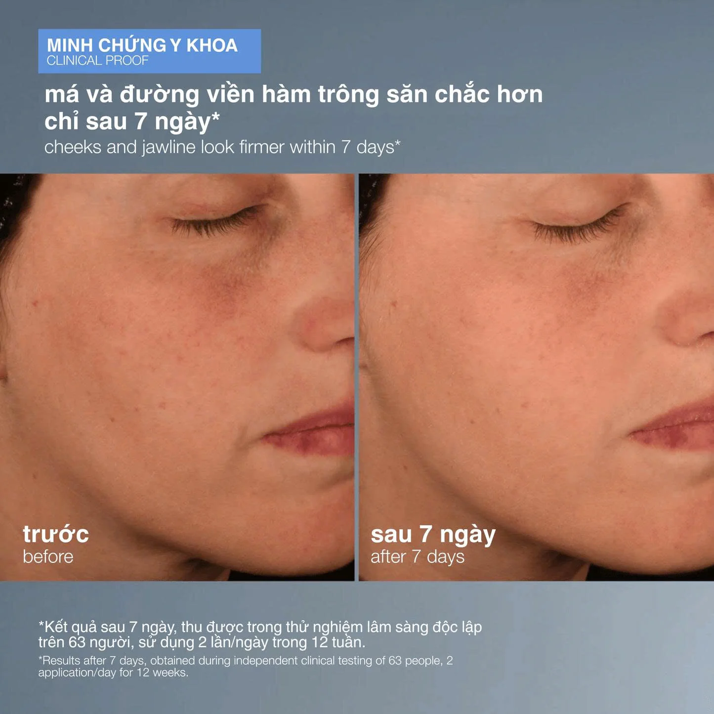 Pro Colla1gen Ban1king Serum