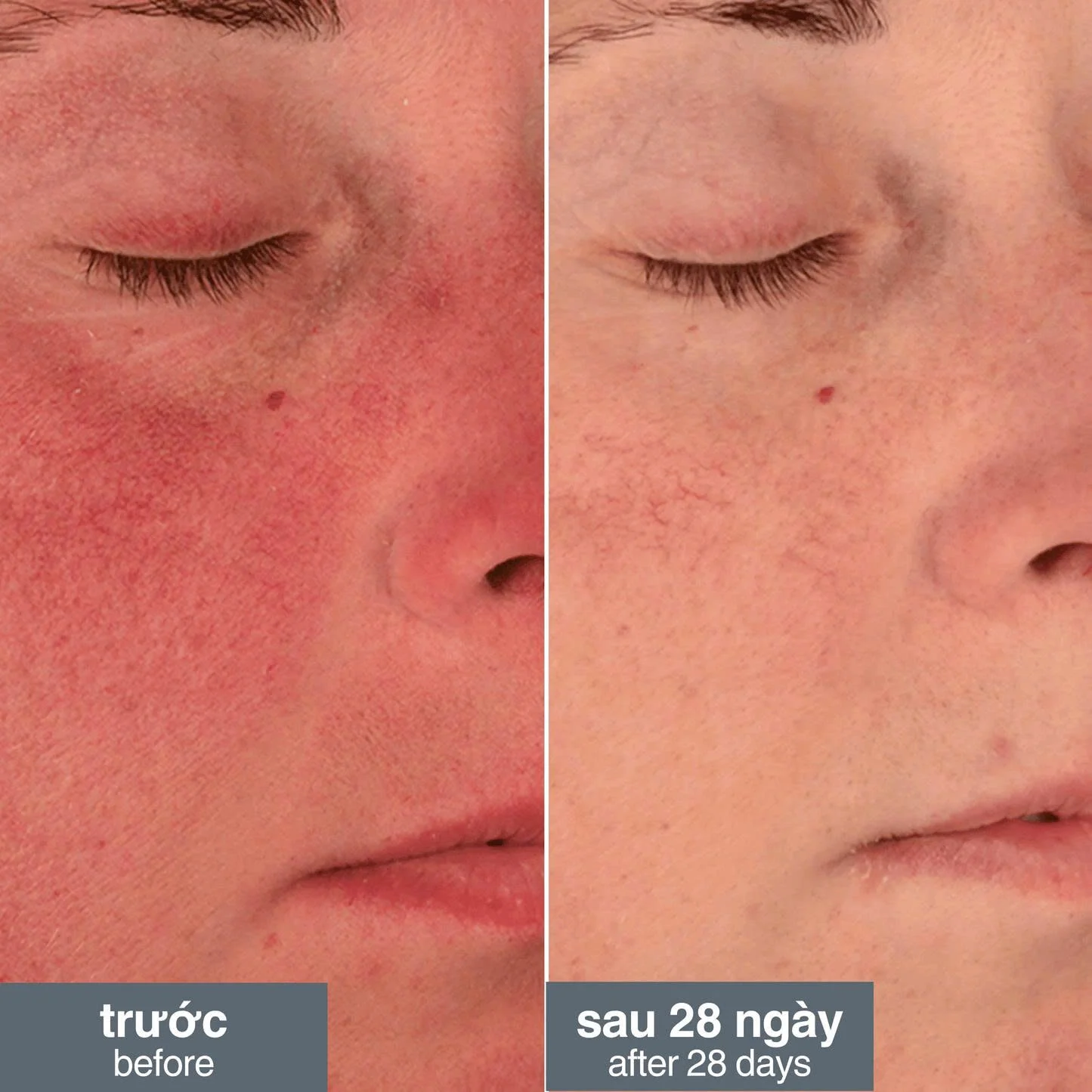 Stabilizing Repair Cream